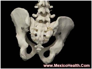tail-bone-removal-in-mexico