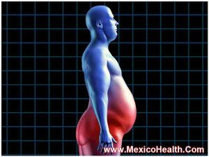 obese-calories-health-fitness-diet-exercise-medical-health