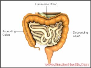colon-resection-in-mexico