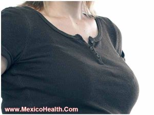 breast-lift-in-tijuana-mexico