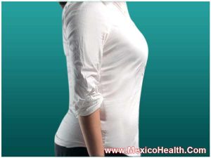 liposuction-in-cancun-mexico
