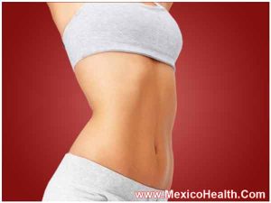 after-liposuction-in-ciudad-juarez
