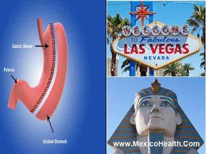 weight-loss-surgery-in-vegas